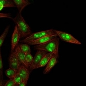 Immunofluorescent staining of human HeLa cells with Nucleophosmin antibody (clone NPM1/3287, green) and phalloidin (red).