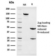 SDS-PAGE analysis of purified, BSA-free Nucleophosmin antibody (clone NPM1/3286) as confirmation of integrity and purity.