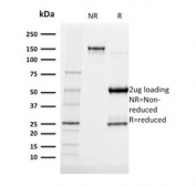 SDS-PAGE analysis of purified, BSA-free Albumin antibody (clone ALB/2141) as confirmation of integrity and purity.