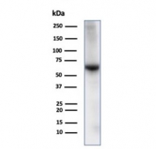 Western blot testing of human liver tissue lysate with Albumin antibody. Predicted molecular weight ~69 kDa.