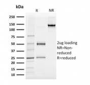 SDS-PAGE analysis of purified, BSA-free Albumin antibody (clone ALB/2142) as confirmation of integrity and purity.