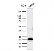 Western blot testing of human Jurkat cell lysate with recombinant CD3e antibody (clone C3e/2858R). Predicted molecular weight ~23 kDa.