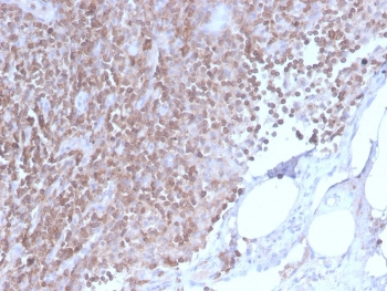 IHC staining of FFPE human lymph node with CD3e antibody (clone C3e/2858R). HIER: boil tissue sections in pH 9 10mM Tris with 1mM EDTA for 10-20 min and allow to cool before testing.~