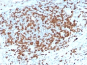 IHC staining of FFPE human tonsil with recombinant CD3e antibody (clone C3e/3125R). HIER: boil tissue sections in pH 9 10mM Tris with 1mM EDTA for 10-20 min and allow to cool before testing.