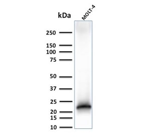 Western blot testing of human MOLT-4 cell lysate with recombinant CD3e antibody (clone C3e/3125R). Predicted molecular weight ~23 kDa.~