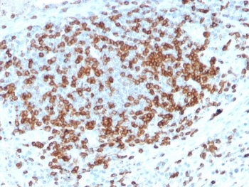 IHC staining of FFPE human tonsil with recombinant CD3e antibody (clone C3e/3125R). HIER: boil tissue