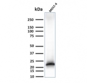 Western blot testing of human MOLT-4 cell lysate with recombinant CD3e antibody (clone C3e/3125R). Predicted molecular weight ~23 kDa.