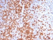 IHC staining of FFPE human tonsil with recombinant CD3e antibody (clone C3e/3125R). HIER: boil tissue sections in pH 9 10mM Tris with 1mM EDTA for 10-20 min and allow to cool before testing.