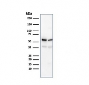 Western blot testing of human K562 (left) and PC-3 cell (right) lysate with SERBP1 antibody. Predicted molecular weight ~45 kDa but observed at 45-60 kDa.