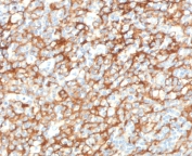 IHC staining of FFPE human tonsil tissue with CD73 antibody (clone CDLA73-1). HIER: boil tissue sections in pH9 10mM Tris with 1mM EDTA for 10-20 min and allow to cool before testing.