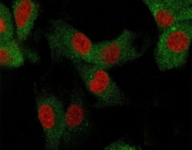 Immunofluorescence staining of human U-87 MG cells with CD73 antibody (green, clone CDLA73-1) and Reddot nuclear stain (red).