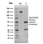 SDS-PAGE analysis of purified, BSA-free Dystrophin antibody (clone DMD/3244) as confirmation of integrity and purity.