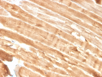 IHC staining of FFPE skeletal muscle with Dystrophin antibody (clone DMD/3244). HIER: boil tissue sections in pH 9 10mM Tris with 1mM EDTA for 10-20 min and allow to cool before testing.~