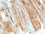 IHC staining of FFPE skeletal muscle with Dystrophin antibody (clone DMD/3243). HIER: boil tissue sections in pH6, 10mM citrate buffer, for 10-20 min and allow to cool before testing.