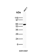 Estrogen Receptor alpha Antibody MCF-7 WB. Western blot analysis of human MCF-7 cell lysate using Estrogen Receptor alpha antibody (clone ESR1/3557) detects a band at approximately 65-70 kDa, consistent with the predicted molecular weight of Estrogen receptor alpha (ESR1).