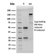 SDS-PAGE analysis of purified, BSA-free CD23 antibody (clone FCER2/3592) as confirmation of integrity and purity.