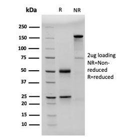 SDS-PAGE analysis of purified, BSA-free CD23 antibody (clon