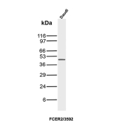 CD23 Antibody Daudi WB. Western blot analysis of Daudi cell lysate using CD23 antibody clone FCER2/3592. A distinct band is detected at approximately 45 kDa, consistent with the predicted molecular weight of Low-affinity immunoglobulin epsilon Fc receptor / FCER2/CD23. The strong signal in this B-cell lineage cell line supports the established role of CD23 in mature B-cell function, IgE receptor signaling, and adaptive immune regulation associated with activated lymphoid populations.
