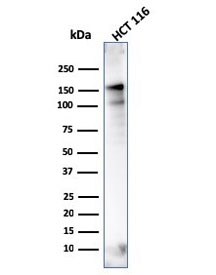 Western blot testing of human HCT116 lysate with MSH6 antibody (clone MSH6/3086). Predicted molecular weight ~160 kDa.