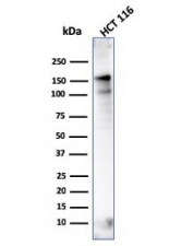 Western blot testing of human HCT116 lysate with MSH6 antibody (clone MSH6/3086). Expected molecular weight: 120-160 kDa depending on phosphorylation level.