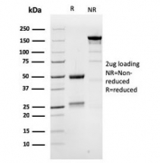 SDS-PAGE analysis of purified, BSA-free MSH6 antibody (clone MSH6/3086) as confirmation of integrity and purity.