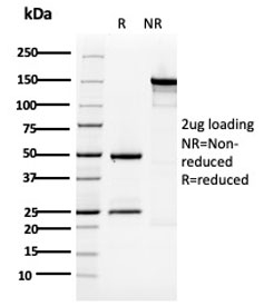 SDS-PAGE analysis of purified, BSA-free Cytokeratin 5 antibody (clone KRT5/3594) as confirmation of integrity and purity.