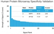 Analysis of HuProt(TM) microarray containing more than 19,000 full-length human proteins using Cytokeratin 5 antibody (clone KRT5/3594). These results demonstrate the foremost specificity of the KRT5/3594 mAb. Z- and S- score: The Z-score represents the strength of a signal that an antibody (in combination with a fluorescently-tagged anti-IgG secondary Ab) produces when binding to a particular protein on the HuProt(TM) array. Z-scores are described in units of standard deviations (SD's) above the mean value of all signals generated on that array. If the targets on the HuProt(TM) are arranged in descending order of the Z-score, the S-score is the difference (also in units of SD's) between the Z-scores. The S-score therefore represents the relative target specificity of an Ab to its intended target.