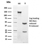 SDS-PAGE analysis of purified, BSA-free NKX3.1 antibody (clone NKX3.1/2576) as confirmation of integrity and purity.