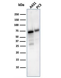 Western blot testing of human 1) A431 and 2) PC-3 cell lysate with CD73 antibody (clone NT5E/2503). Predicted molecular weight: 60-70 kDa.