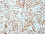 IHC staining of FFPE human tonsil tissue with CD73 antibody (clone NT5E/2503). HIER: boil tissue sections in pH9 10mM Tris with 1mM EDTA for 10-20 min and allow to cool before testing.