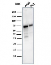 Western blot testing of human 1) A431 and 2) PC-3 cell lysate with CD73 antibody (clone NT5E/2503). Predicted molecular weight: 60-70 kDa
