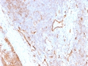 IHC staining of FFPE human tonsil tissue with CD73 antibody (clone NT5E/2505). HIER: boil tissue sections in pH9 10mM Tris with 1mM EDTA for 10-20 min and allow to cool before testing.