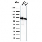 Western blot testing of human 1) A431 and 2) PC-3 cell lysate with CD73 antibody (clone NT5E/2505). Predicted molecular weight: 60-70 kDa.