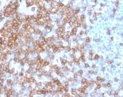 IHC staining of FFPE human spleen with CD43 antibody (clone CDLA43-2). HIER: boil tissue sections in pH 9 10mM Tris with 1mM EDTA for 10-20 min and allow to cool before testing.