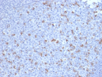 IHC staining of FFPE human tonsil with PDCD1 antibody (clone PDCD1/2720). HIER: boil tissue sections in pH9 10mM Tris with 1mM EDTA for 10-20 min and allow to cool before testing.~