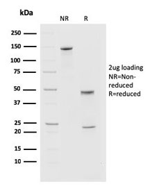 SDS-PAGE analysis of purified, BSA-free PDCD1 antibody (