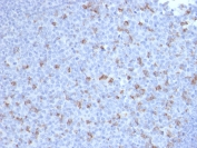IHC staining of FFPE human tonsil with PDCD1 antibody (clone PDCD1/2720). HIER: boil tissue sections in pH9 10mM Tris with 1mM EDTA for 10-20 min and allow to cool before testing.