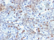 IHC staining of FFPE human kidney with RORC antibody (clone RORC/2941). HIER: boil tissue sections in pH6, 10mM citrate buffer, for 10-20 min and allow to cool before testing.