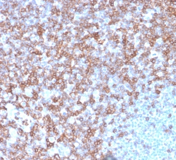 IHC staining of FFPE human spleen with CD43 antibody (clone SPN/3388). HIER: boil tissue sections in pH 9 10mM Tris with 1mM EDTA for 10-20 min and allow to cool before testing.~