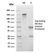 SDS-PAGE analysis of purified, BSA-free VISTA antibody (clone VISTA/3006) as confirmation of integrity and purity.