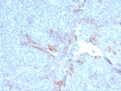 IHC staining of FFPE human tonsil with TIM3 antibody (clone TIM3/3113). HIER: boil tissue sections in pH 9 10mM Tris with 1mM EDTA for 10-20 min and allow to cool before testing.