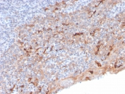 IHC staining of FFPE human tonsil with TIM3 antibody (clone TIM3/3113). HIER: boil tissue sections in pH 9 10mM Tris with 1mM EDTA for 10-20 min and allow to cool before testing.