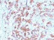 IHC staining of FFPE human adrenal gland with TIM3 antibody (clone TIM3/3113). HIER: boil tissue sections in pH 9 10mM Tris with 1mM EDTA for 10-20 min and allow to cool before testing.