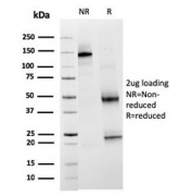 SDS-PAGE analysis of purified, BSA-free TIM3 antibody (clone TIM3/3113) as confirmation of integrity and purity.