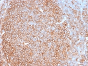 IHC testing of FFPE human tonsil tissue with recombinant Pan-HLA antibody (clone HLA-Pan/2967R). Required HIER: boil tissue sections in 10mM citrate buffer, pH 6, for 10-20 min and allow to cool prior to testing.