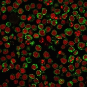 Immunofluorescence staining of human Ramos cells with Pan-HLA antibody (green, clone HLA-Pan/2967R) and Reddot nuclear stain (red).