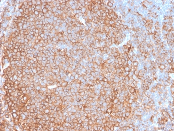 IHC testing of FFPE human tonsil tissue with recombinant Pan-HLA antibody (clone HLA-Pan/2967R). Required HIER: boil tissue sections in 10mM citrate buffer, pH 6, for 10-20 min and allow to cool prior to testing.~