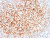 IHC staining of FFPE human tonsil tissue with CD73 antibody (clone NT5E/2545). HIER: boil tissue sections in pH9 10mM Tris with 1mM EDTA for 10-20 min and allow to cool before testing.