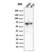 Western blot testing of human 1) A431 and 2) PC-3 cell lysate with CD73 antibody (clone NT5E/2545). Predicted molecular weight: 60-70 kDa.