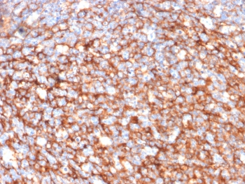 IHC staining of FFPE human tonsil tissue with CD73 antibody (clone NT5E/2646). HIER: boil tissue sections in pH9 10mM Tris with 1mM EDTA for 10-20 min and allow to cool before testing.
